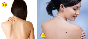 6 nốt ruồi cực hiếm, không thăng quan cũng phát tài